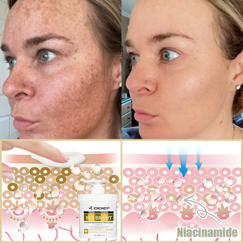 ๐๐ผ๐ฟ๐ผ๐ป๐ฑ๐ยฎ Bee Bright Skin Care Cream for Aging, Dryness, Dullness and Uneven Skin Tone - Suitable for face & body