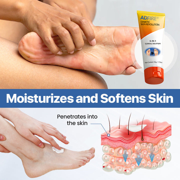 ADFIRE® Diabetic Skin Revolution – 6-IN-1 Clinical Solution 🦶 24H Flash Sale!