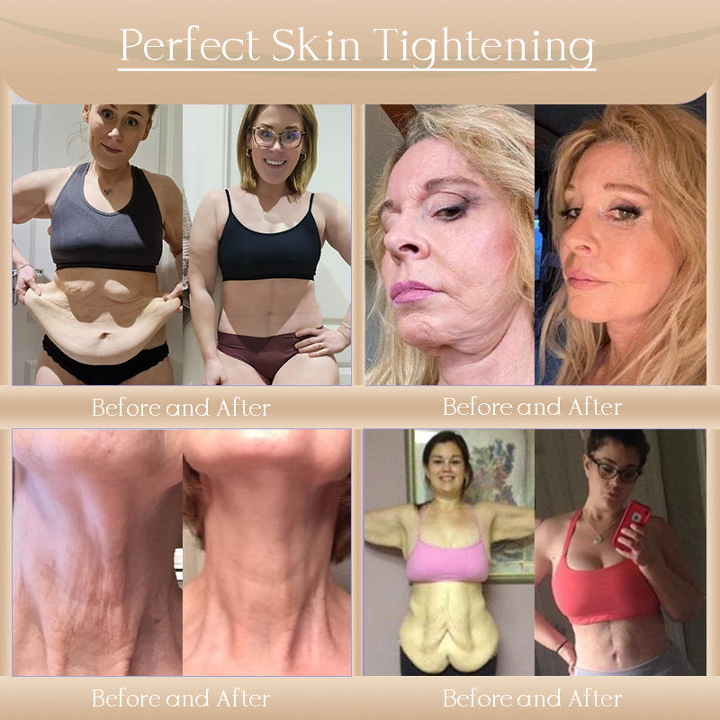 ๐๐ผ๐ฟ๐ผ๐ป๐ฑ๐ยฎ Bee Bright Skin Care Cream for Aging, Dryness, Dullness and Uneven Skin Tone - Suitable for face & body