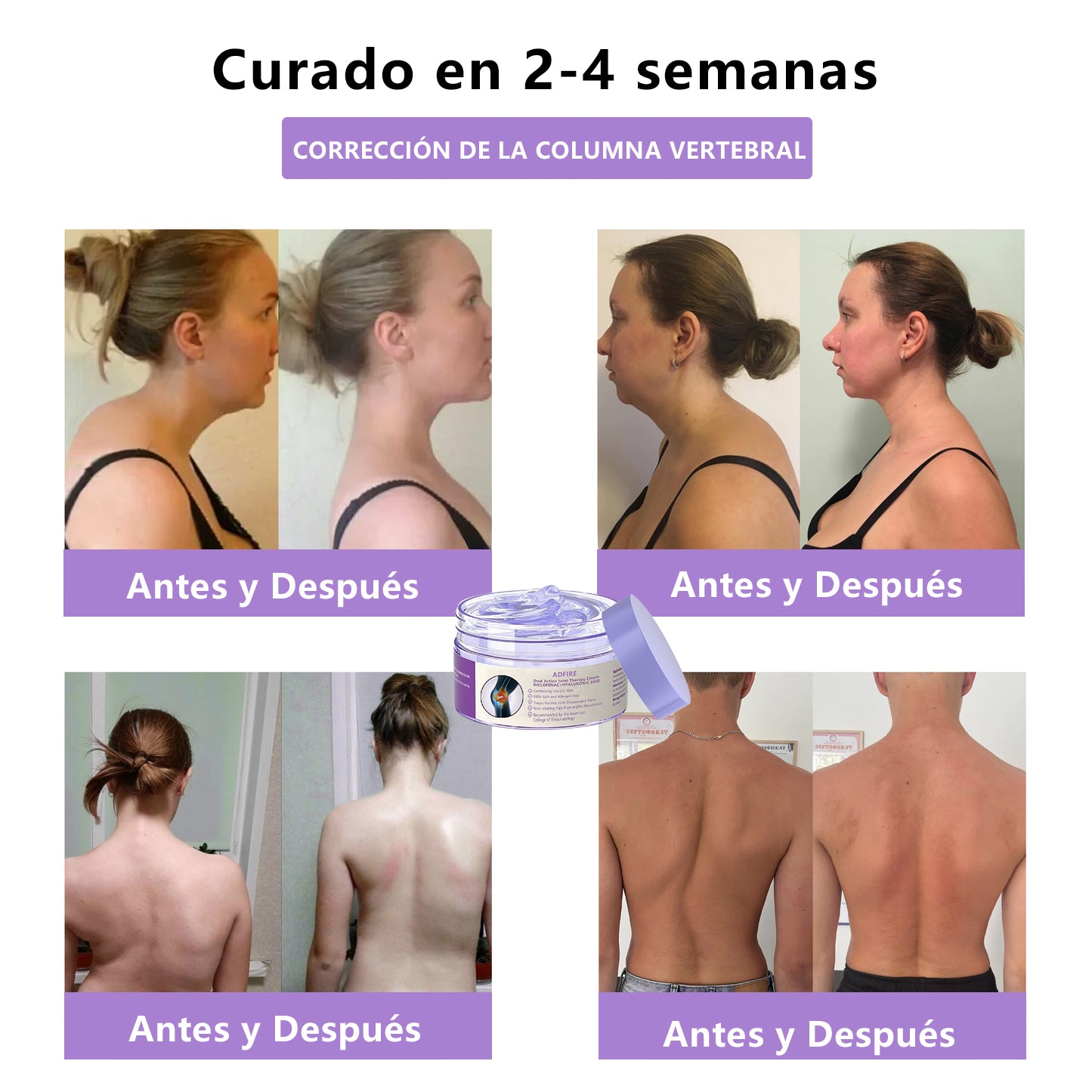 Gel Terapéutico de Acción Dual ADFIRE® para las Articulaciones 🌿