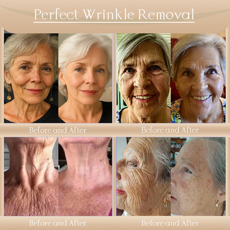๐๐ผ๐ฟ๐ผ๐ป๐ฑ๐ยฎ Bee Bright Skin Care Cream for Aging, Dryness, Dullness and Uneven Skin Tone - Suitable for face & body