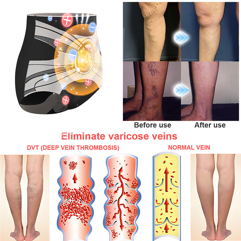 2025 Best Seller🔥Anyidea® Magnetic Therapy Shaping Shorts :Certified Health Benefits & Slimming Power – 90% OFF, Last Day!