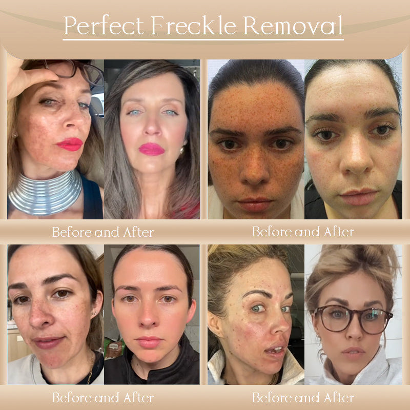 ๐๐ผ๐ฟ๐ผ๐ป๐ฑ๐ยฎ Bee Bright Skin Care Cream for Aging, Dryness, Dullness and Uneven Skin Tone - Suitable for face & body
