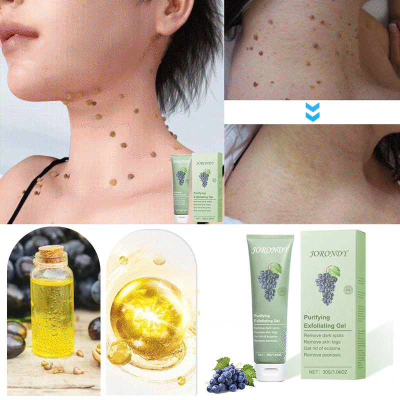 Jorondy® 🍇Grapeseed Purifying Exfoliating Gel – 94% OFF, Last Day!