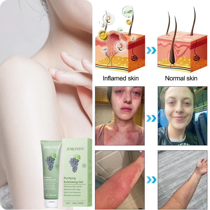 Jorondy® 🍇Grapeseed Purifying Exfoliating Gel – 94% OFF, Last Day!