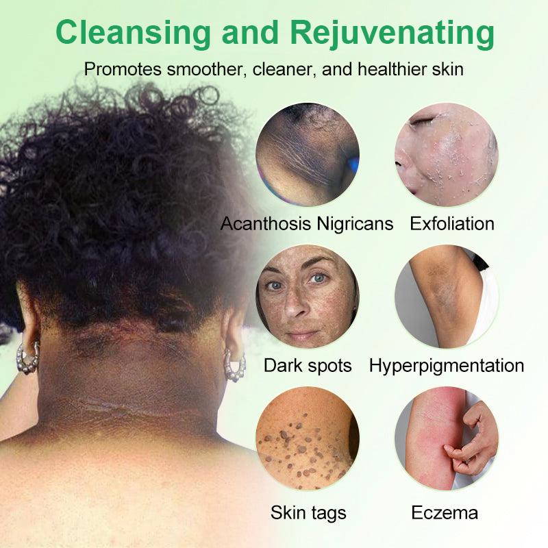 Jorondy® 🍇Grapeseed Purifying Exfoliating Gel – 94% OFF, Last Day!