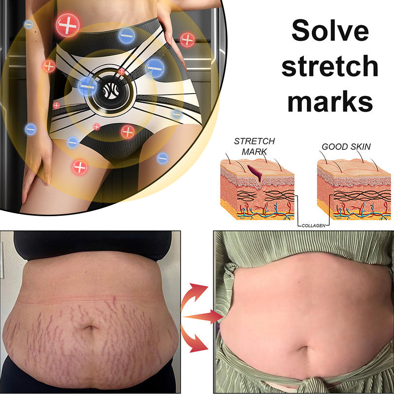 2025 Best Seller🔥Anyidea® Magnetic Therapy Shaping Shorts :Certified Health Benefits & Slimming Power – 90% OFF, Last Day!