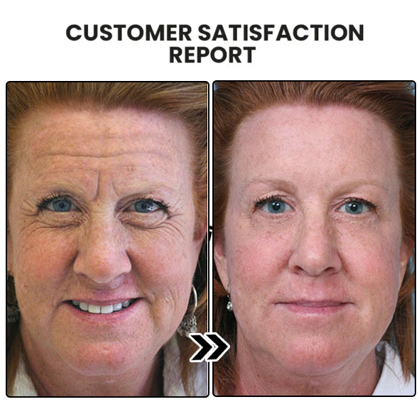 Warebrill Anti-Aging Facial Serum - š„Last Day Promotion 90% OFF