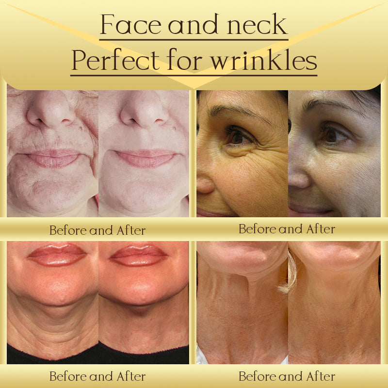 Jorondy® AH-8 Skin Firming Cream ✨ Clinically Proven Skin Tightening ✨🔥 Limited Stock & Time Offer! 🔥