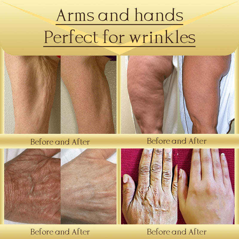 Jorondy® AH-8 Skin Firming Cream ✨ Clinically Proven Skin Tightening ✨🔥 Limited Stock & Time Offer! 🔥