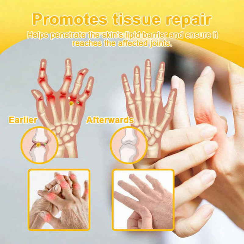 ADFIRE® Bee Venom Pain-Relief Bone Healing Spray🐝🐝(Specially for older adults & AAOS recommends)