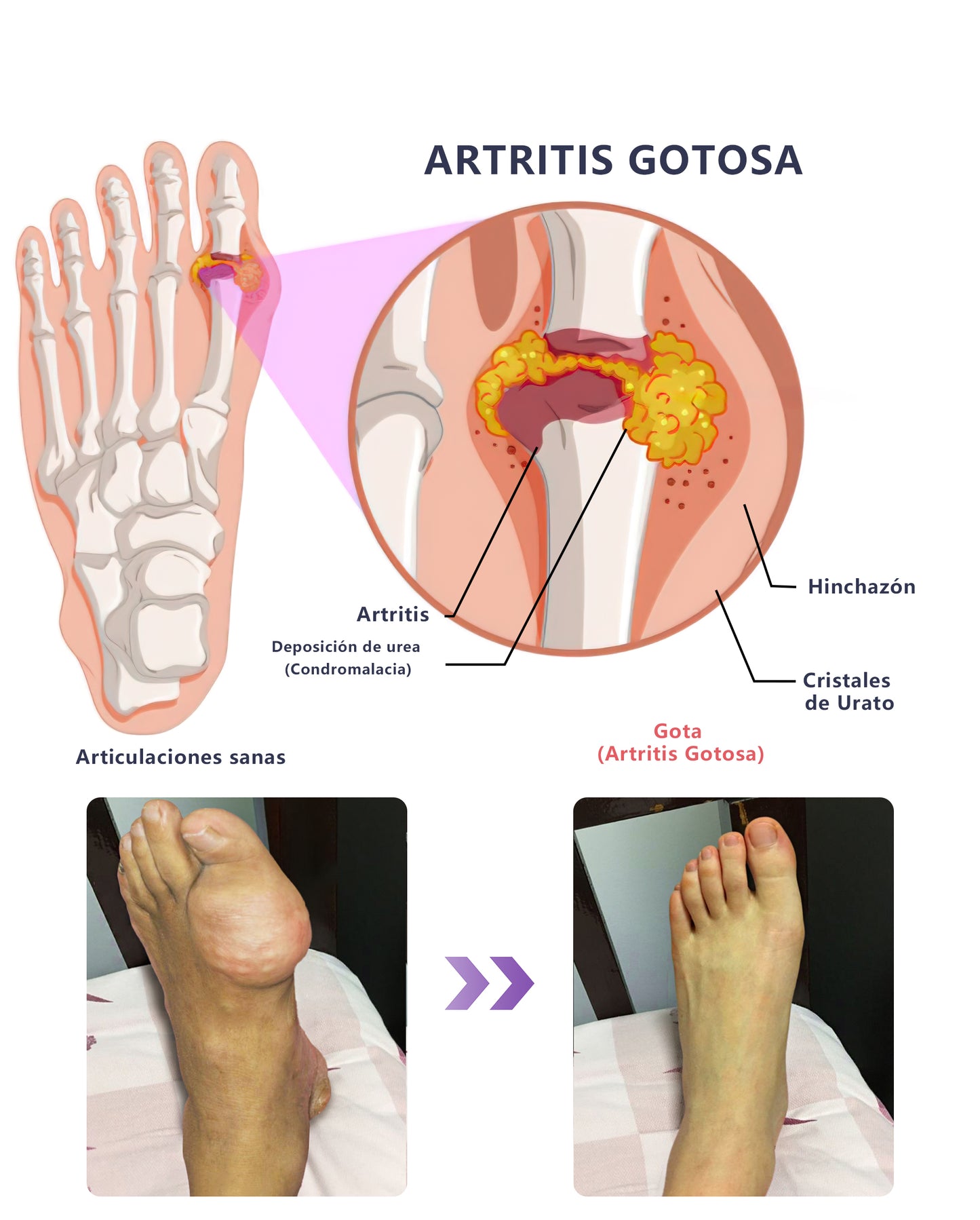 Gel Terapéutico de Acción Dual ADFIRE® para las Articulaciones 🌿