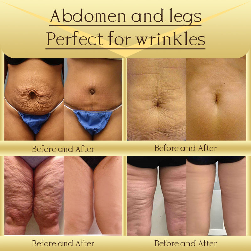 Jorondy® AH-8 Skin Firming Cream ✨ Clinically Proven Skin Tightening ✨🔥 Limited Stock & Time Offer! 🔥