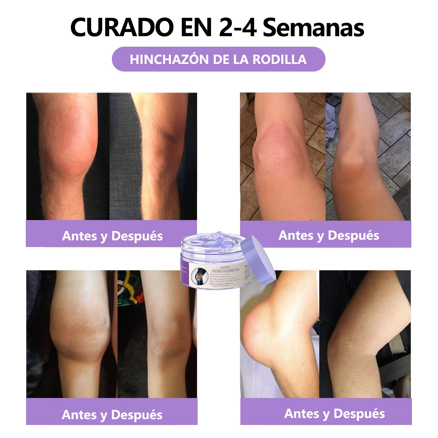 Gel Terapéutico de Acción Dual ADFIRE® para las Articulaciones 🌿