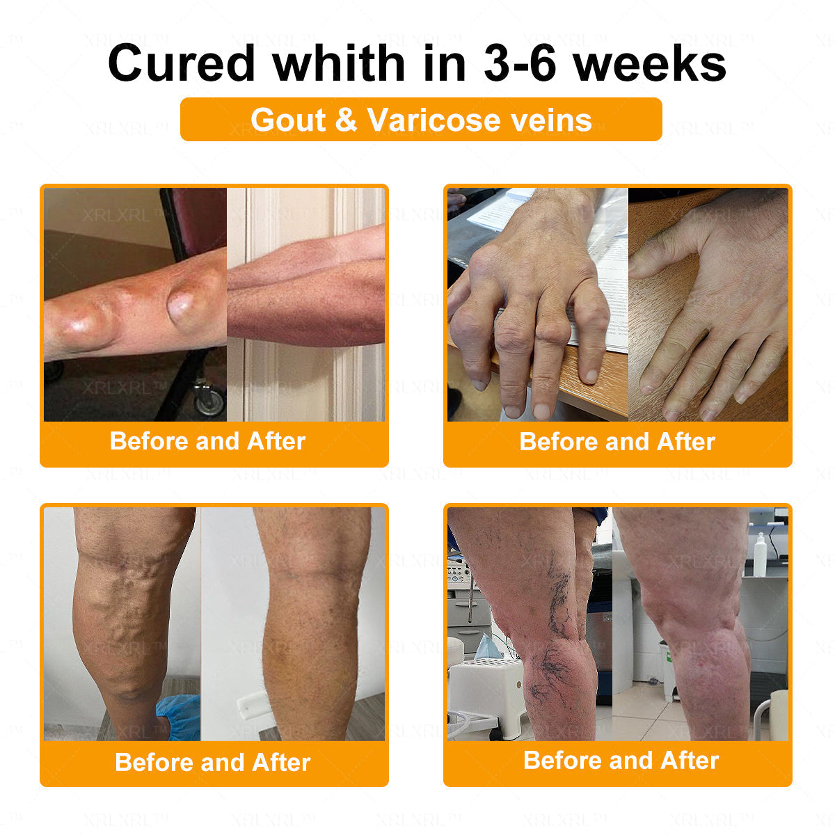 ADFIRE® Bee Venom Pain-Relief Bone Healing Spray🐝🐝(Specially for older adults & AAOS recommends)