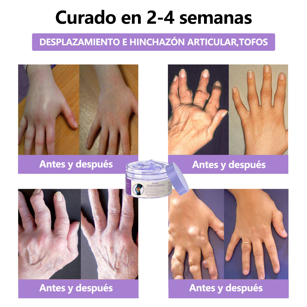 Gel Terapéutico de Acción Dual ADFIRE® para las Articulaciones 🌿