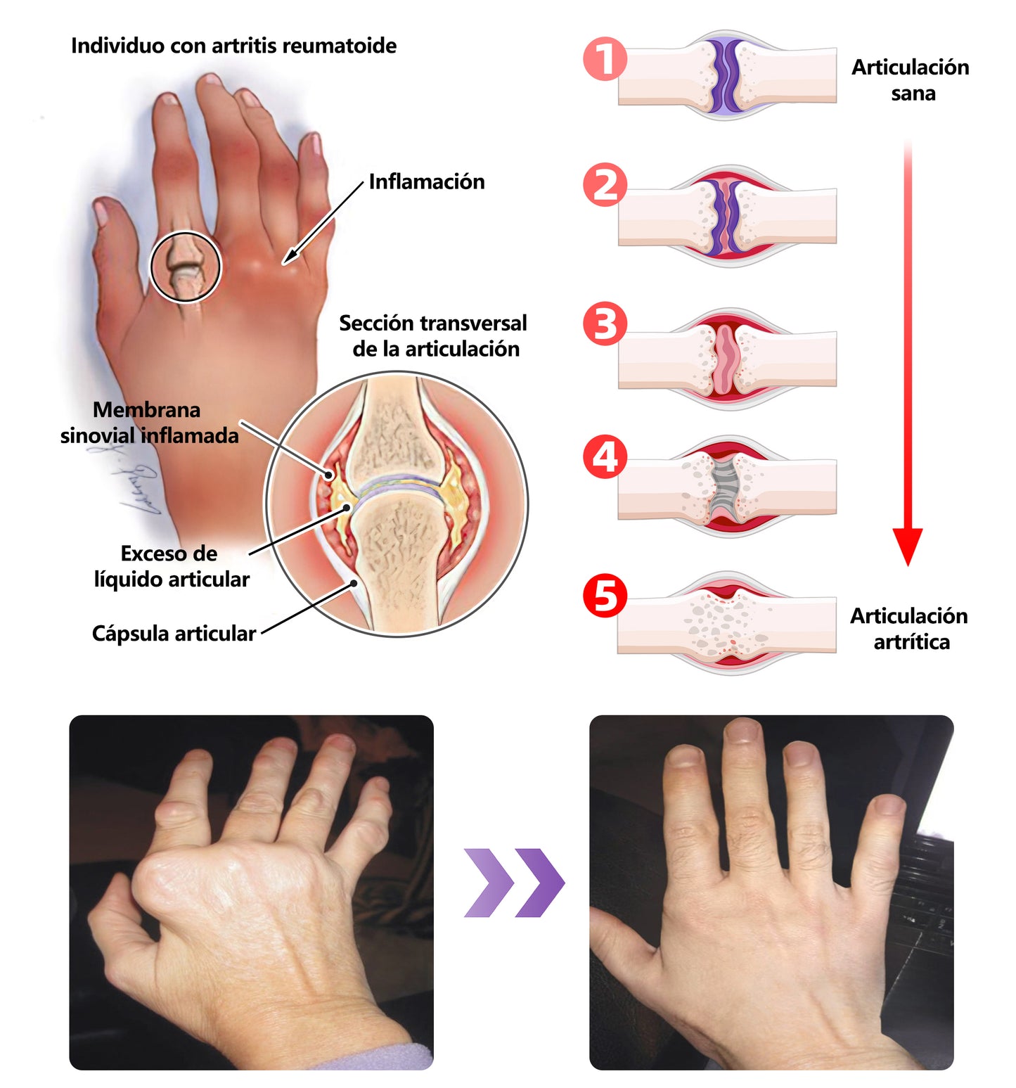 Gel Terapéutico de Acción Dual ADFIRE® para las Articulaciones 🌿
