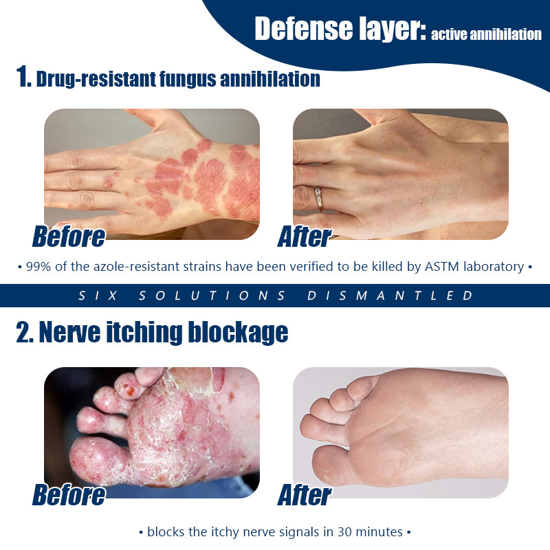 ADFIRE® Diabetic Skin Revolution – 6-IN-1 Clinical Solution 👨⚕️ 24H Flash Sale!