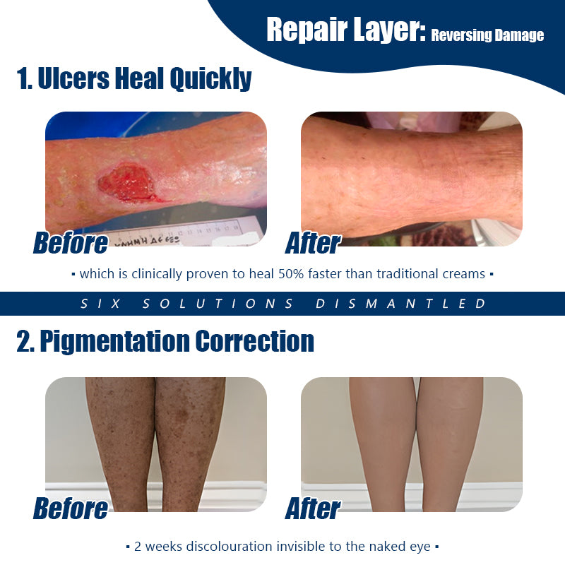 ADFIRE® Diabetic Skin Revolution – 6-IN-1 Clinical Solution 👨⚕️ 24H Flash Sale!