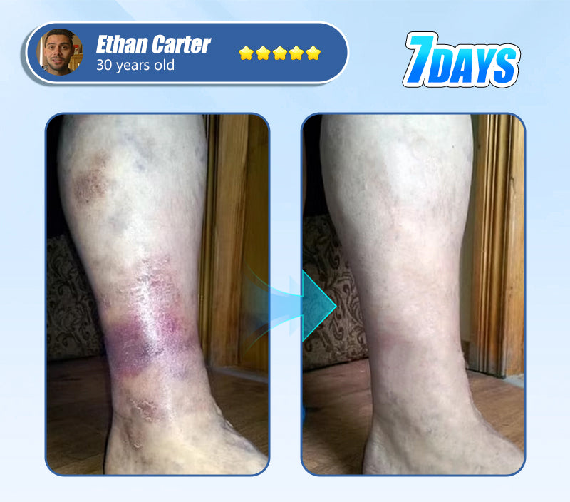 ADFIRE® Diabetic Skin Revolution – 6-IN-1 Clinical Solution 🦶 24H Flash Sale!