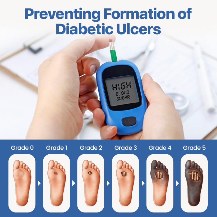 ADFIRE® Diabetic Treatment Cream – Clinically Tested for Ulcer Care 🇺🇸 24H Flash Sale!