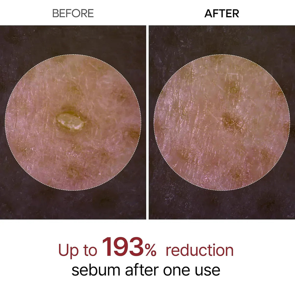 TLOPA Rice Peel Glow Serum Ampoule Gentle Daily Exfoliation for Radiant, Smoother Skin — Powered by Rice Water, AHA + BHA & Niacinamide