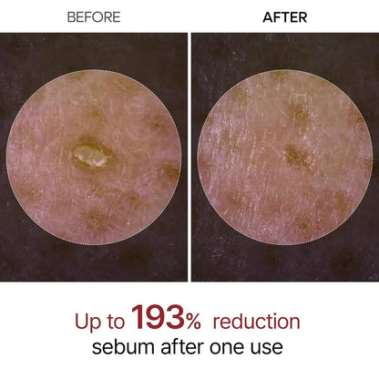 TLOPA Rice Peel Glow Serum Ampoule Gentle Daily Exfoliation for Radiant, Smoother Skin — Powered by Rice Water, AHA + BHA & Niacinamide