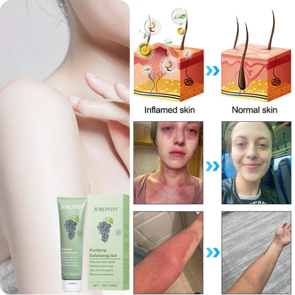 Jorondy® 🍇Grapeseed Purifying Exfoliating Gel – 94% OFF, Last Day!
