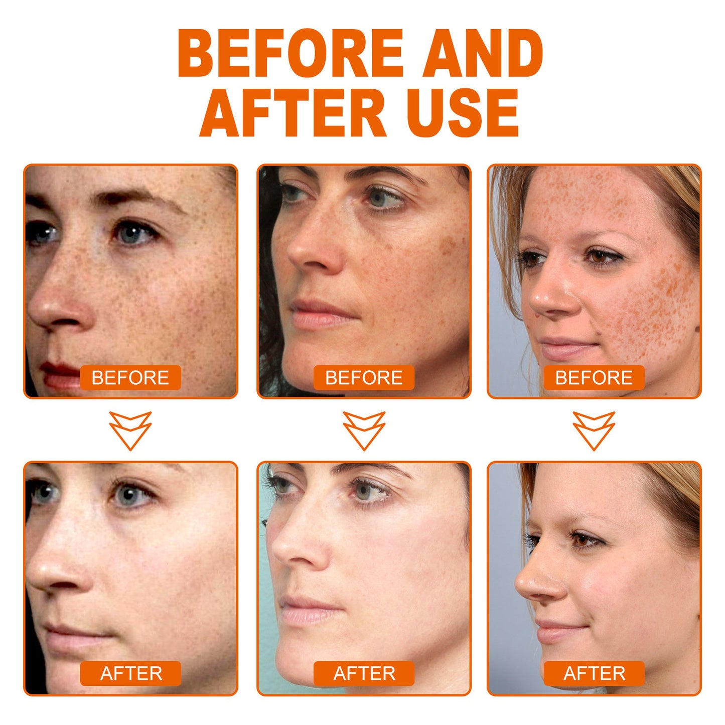 (Daily Sales of 7633+🔥) - 𝗝𝗼𝗿𝗼𝗻𝗱𝘆® Honey Tear-Off Mask Anti-Aging, Deep Cleansing, Reduces Fine Lines＆ Wrinkles Great for All Skin