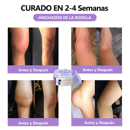Gel Terapéutico de Acción Dual ADFIRE® para las Articulaciones 🌿