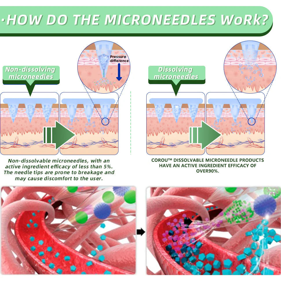 COROU® SMGT-GLP-1 Microneedle Patch - Painless, long-lasting, addressing diabetes, obesity, and cardiovascular diseases