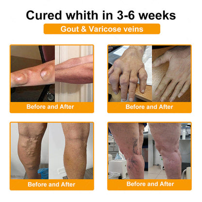 ADFIRE® Bee Venom Relief & Skin Support Spray 🐝🐝 For Joint Comfort, Bruise Care & Age-Related Skin Marks
