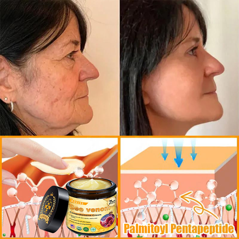Made and Shipped from USA ✨ ADFIRE® Bee venom Comprehensive Cream 🔥 LAST DAY 80% OFF 💎💎