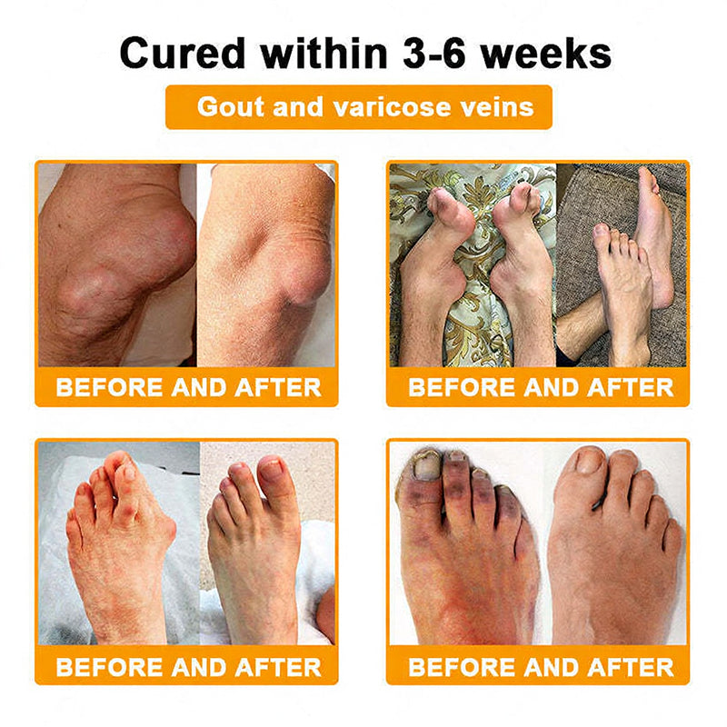ADFIRE® Bee Venom Relief & Skin Support Spray 🐝🐝 For Joint Comfort, Bruise Care & Age-Related Skin Marks