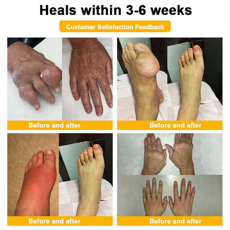 ADFIRE® Bee Venom Relief & Skin Support Spray 🐝🐝 For Joint Comfort, Bruise Care & Age-Related Skin Marks
