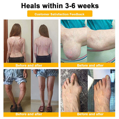ADFIRE® Bee Venom Relief & Skin Support Spray 🐝🐝 For Joint Comfort, Bruise Care & Age-Related Skin Marks