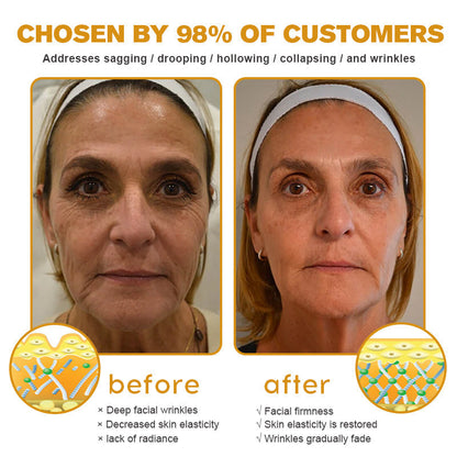 Jorondy®  Instant skin tightening Cream:- LAST DAY 80% OFF