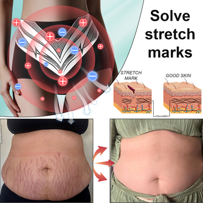 Congratulations on getting 50% discount! Only the last 5 left in stock! Our products are FDA approved! Complete transformation within 3 weeks!